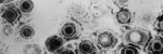 Herpes Simplex Virus (HSV) 1 and 2