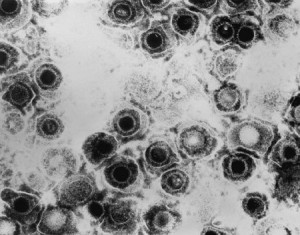 herpes simplex virus 1 and 2